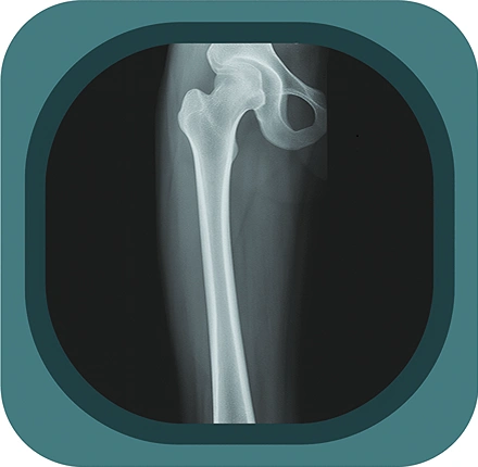 x ray femour anatomy icon-1771230434